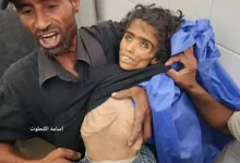 Emaciated child of Gaza named Baraa Abu Sila, victim of starvation due to Israeli-American blockade.