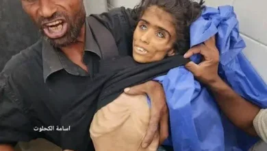 Emaciated child of Gaza named Baraa Abu Sila, victim of starvation due to Israeli-American blockade.