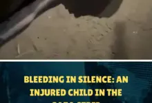 Bleeding in Silence: An Injured Child in the Gaza Strip
